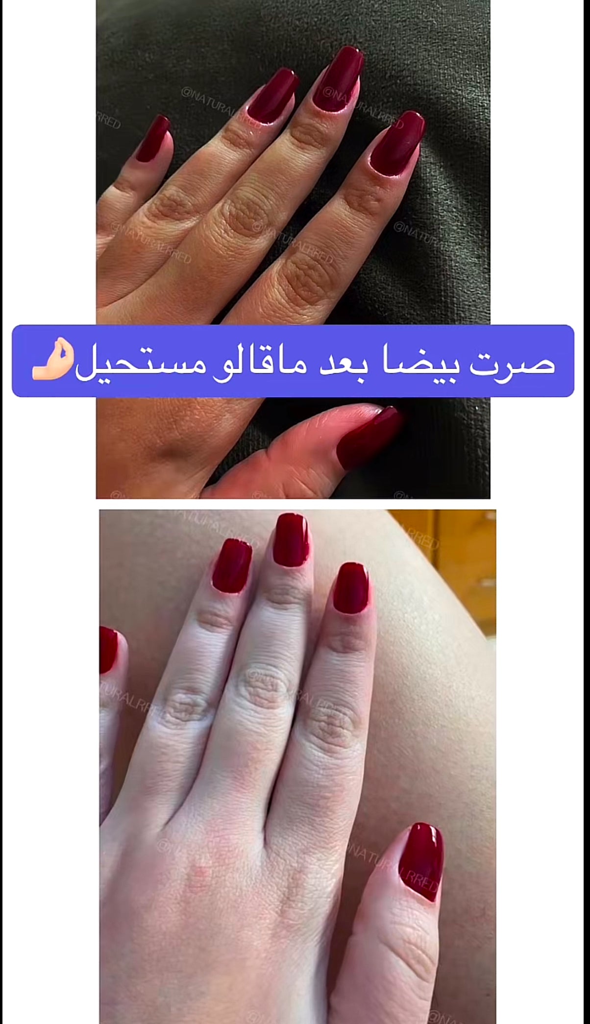 بشرة أفتح، نقية، ومتوهجة… بشكل طبيعي